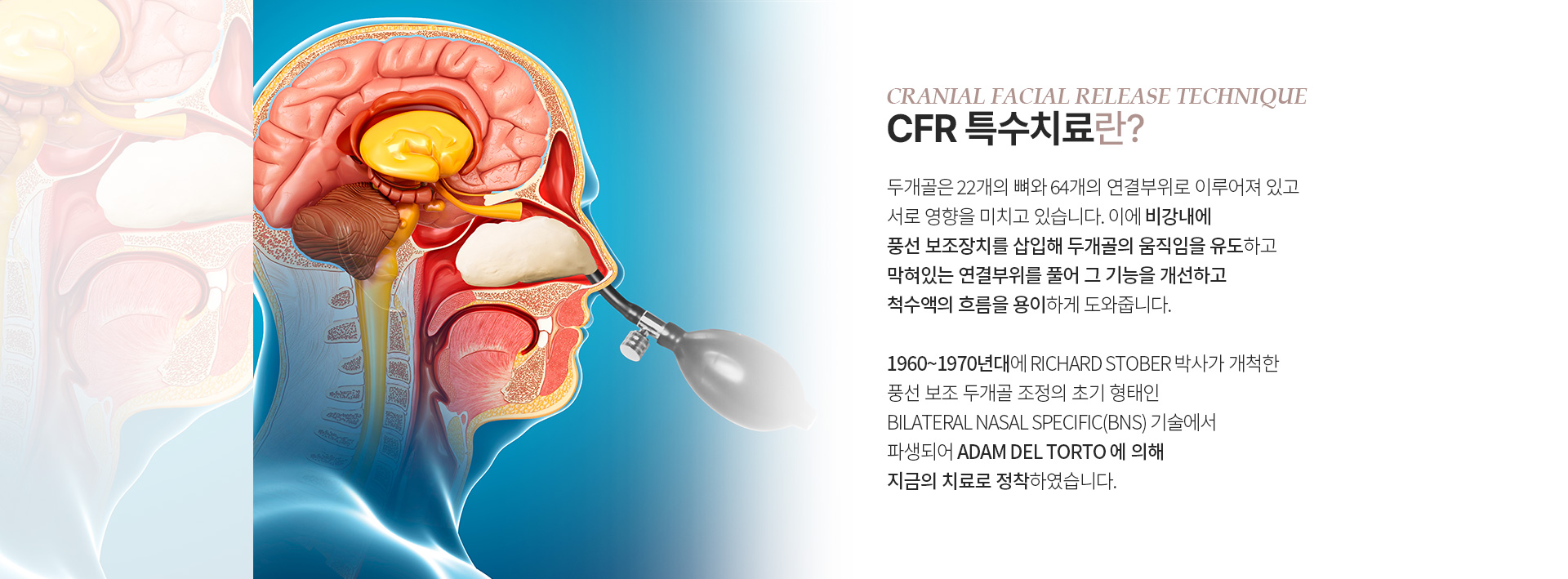 CFR 특수치료 란? 